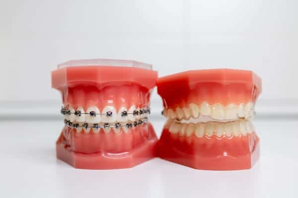 Airway orthodontics to treat obstructive sleep apnea in Flower Mound TX