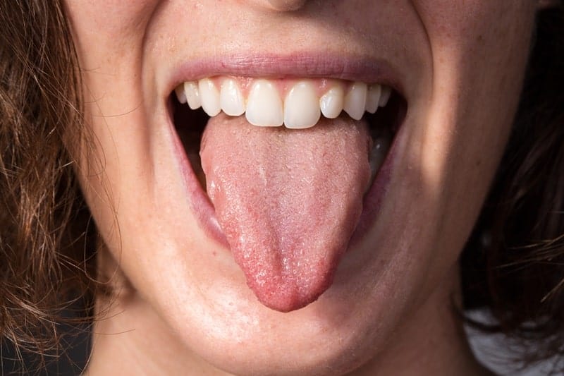 Poor muscle tone in throat and tongue causing snoring