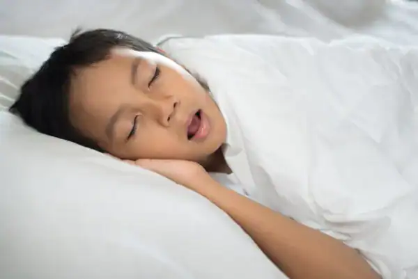 Contributing factors to sleep apnea including weight