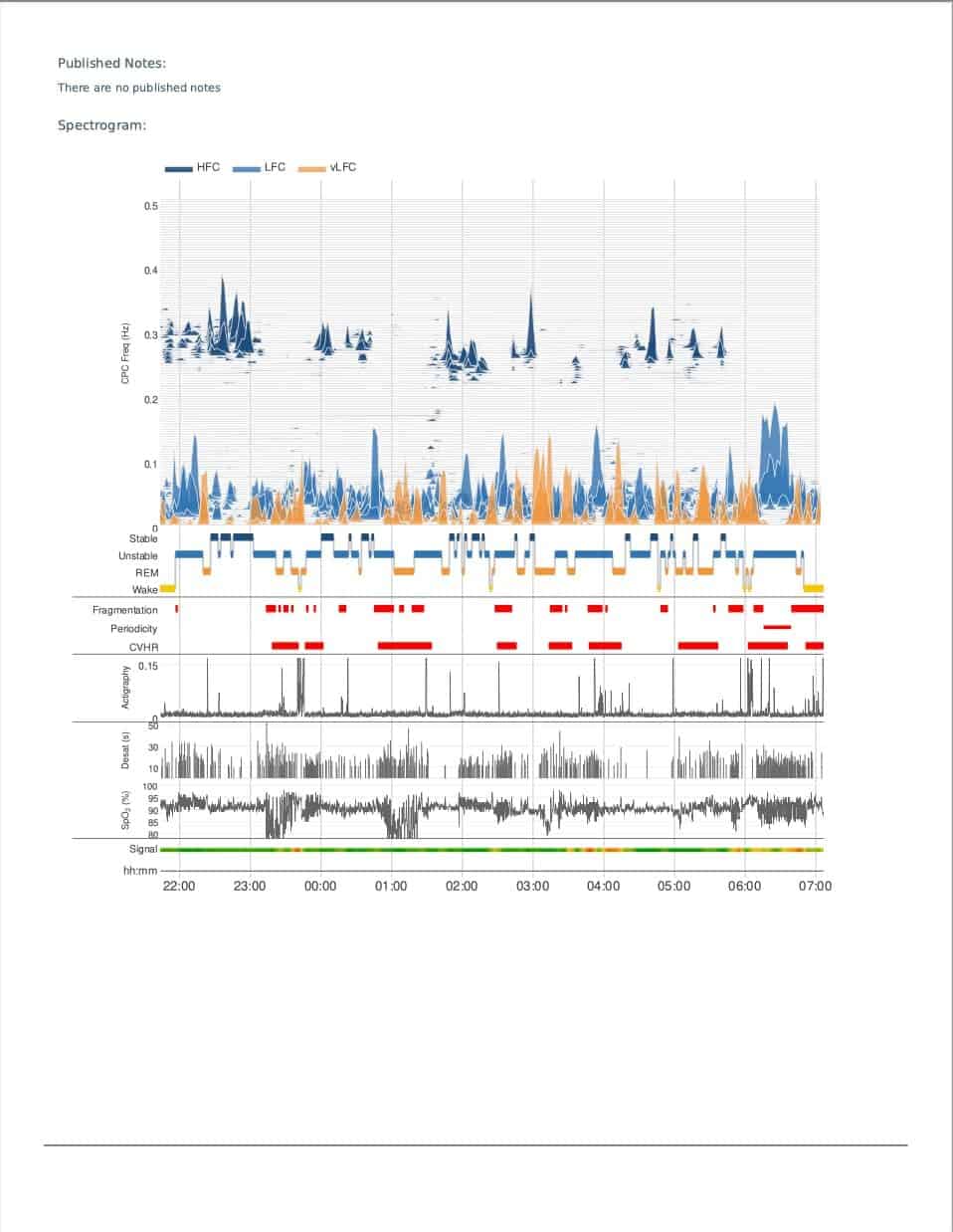 Personalized Pediatric Sleep Study Plan Results